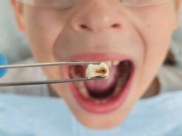 Best Walk-In Emergency Dental Services in Robertsde, AL